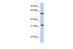 Aviva Systems Biology Corp CDC34 Antibody - middle region (AVARP03048_P050)