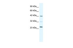 Aviva Systems Biology Corp E2F1 Antibody - C-terminal region (AVARP04006_P050)