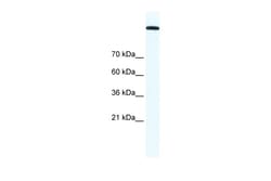 Aviva Systems Biology Corp TOP2A Antibody - C-terminal region (AVARP04007_T100)