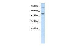 Aviva Systems Biology Corp MDM4 Antibody - N-terminal region (AVARP06007_P050)