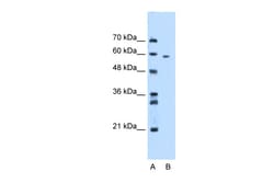 Aviva Systems Biology Corp MDM4 Antibody - N-terminal region (AVARP06007_T100)