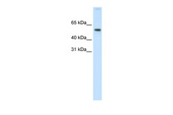 Aviva Systems Biology Corp AKT1 Antibody - N-terminal region (AVARP06008_P050)