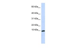 Aviva Systems Biology Corp CXCL9 Antibody - middle region (AVARP07022_P050)