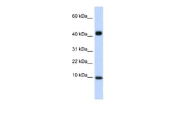 Aviva Systems Biology Corp CCL8 Antibody - middle region (AVARP07026_P050)