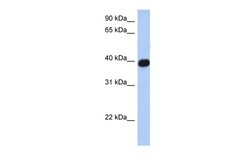 Aviva Systems Biology Corp CXCR6 Antibody - N-terminal region (AVARP07030_P050)