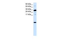 Aviva Systems Biology Corp CXCL1 Antibody - middle region (AVARP07032_P050)