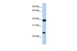 Aviva Systems Biology Corp GPR15 Antibody - N-terminal region (AVARP07041_P050)