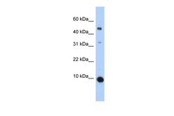 Aviva Systems Biology Corp CCL2 Antibody - middle region (AVARP07046_P050)