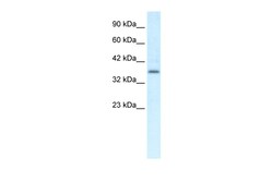 Aviva Systems Biology Corp CMKLR1 Antibody - C-terminal region (AVARP07056_P050)