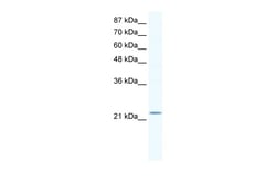 Aviva Systems Biology Corp RGS10 Antibody - middle region (AVARP09013_T100)