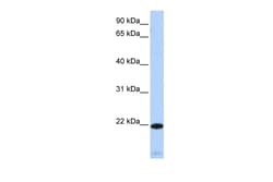 Aviva Systems Biology Corp RGS5 Antibody - middle region (AVARP09015_P050)
