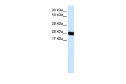 Aviva Systems Biology Corp CAV3 Antibody - N-terminal region (AVARP09021_P050)