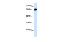 Aviva Systems Biology Corp EIF2AK2 Antibody - C-terminal region (AVARP09033_P050)