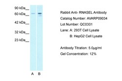 Aviva Systems Biology Corp RNASEL Antibody - C-terminal region (AVARP09034_T100)