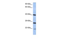Aviva Systems Biology Corp CIDEB Antibody - middle region (AVARP09043_P050)