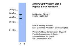 Aviva Systems Biology Corp PDCD4 Antibody - N-terminal region (AVARP09045_T100)