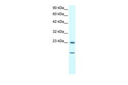 Aviva Systems Biology Corp HSPB1 Antibody - C-terminal region (AVARP09060_T100)