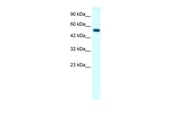 Aviva Systems Biology Corp GLRA1 Antibody - middle region (AVARP13003_P050)
