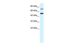 Aviva Systems Biology Corp CHML Antibody - N-terminal region (AVARP13012_P050)