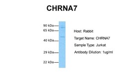 Aviva Systems Biology Corp CHRNA7 Antibody - N-terminal region (AVARP13018_T100)
