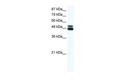 Aviva Systems Biology Corp CHRNB2 Antibody - N-terminal region (AVARP13020_P050)