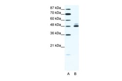 Aviva Systems Biology Corp CHRNB2 Antibody - N-terminal region (AVARP13020_T100)