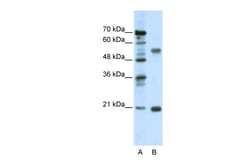 Aviva Systems Biology Corp CHRNB3 Antibody - middle region (AVARP13021_P050)