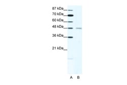 Aviva Systems Biology Corp CHRND Antibody - N-terminal region (AVARP13022_T100)
