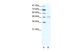 Aviva Systems Biology Corp GABRA2 Antibody - middle region (AVARP13026_T100)