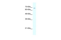 Aviva Systems Biology Corp GABRD Antibody - N-terminal region (AVARP13032_T100)