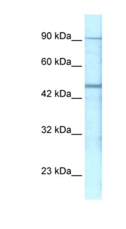 Aviva Systems Biology Corp GABRP Antibody - N-terminal region (AVARP13034_P050)