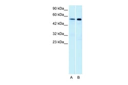 Aviva Systems Biology Corp HTR1A Antibody - N-terminal region (AVARP13041_T100)