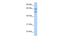Aviva Systems Biology Corp HTR2A Antibody - N-terminal region (AVARP13044_P050)