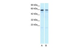 Aviva Systems Biology Corp HTR2C Antibody - N-terminal region (AVARP13045_T100)