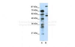 Aviva Systems Biology Corp HTR7 Antibody - N-terminal region (AVARP13048_T100)