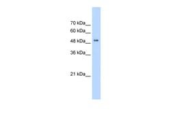 Aviva Systems Biology Corp PACSIN1 Antibody - C-terminal region (AVARP13052_T100)