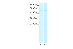 Aviva Systems Biology Corp CHRNA2 Antibody - N-terminal region (AVARP13064_T100)