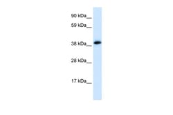 Aviva Systems Biology Corp CHRNA1 Antibody - C-terminal region (AVARP13084_P050)