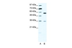 Aviva Systems Biology Corp GDI1 Antibody - C-terminal region (AVARP13086_T100)