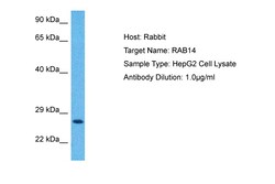 Aviva Systems Biology Corp RAB14 Antibody - C-terminal region (AVARP13107_P050)