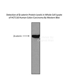 Aviva Systems Biology Corp CTNNB1 Antibody - C-terminal region (AVARP14001_T100)