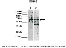 Aviva Systems Biology Corp MMP2 Antibody - C-terminal region (AVARP20016_T100)