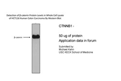 Aviva Systems Biology Corp CTNNB1 Antibody - N-terminal region (P100600_T100)