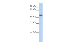 Aviva Systems Biology Corp DEK Antibody - middle region (P100602_P050)