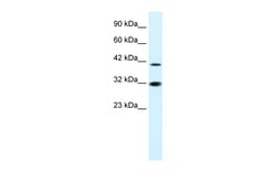 Aviva Systems Biology Corp IRF2 Antibody - N-terminal region (P100613_P050)