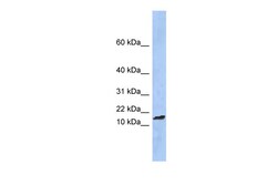 Aviva Systems Biology Corp TAL2 Antibody - middle region (P100623_P050)