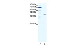 Aviva Systems Biology Corp TAL1 Antibody - C-terminal region (P100630_T100)