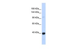 Aviva Systems Biology Corp VAV1 Antibody - middle region (P100685_P050)