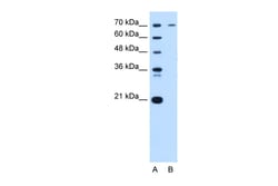 Aviva Systems Biology Corp PGR Antibody - N-terminal region (P100687_P050)