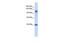 Aviva Systems Biology Corp RFX1 Antibody - C-terminal region (P100690_P050)